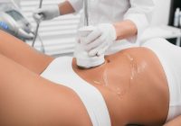 Laser Liposuction