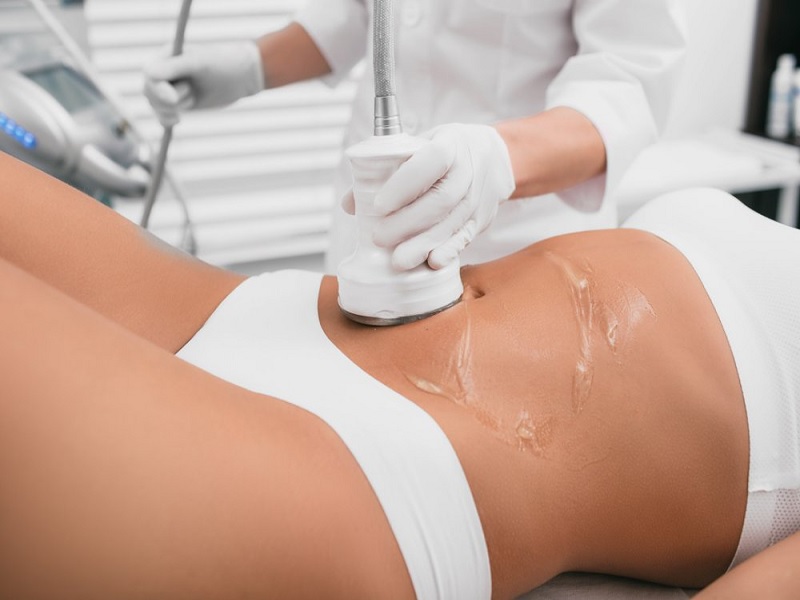 Laser Liposuction